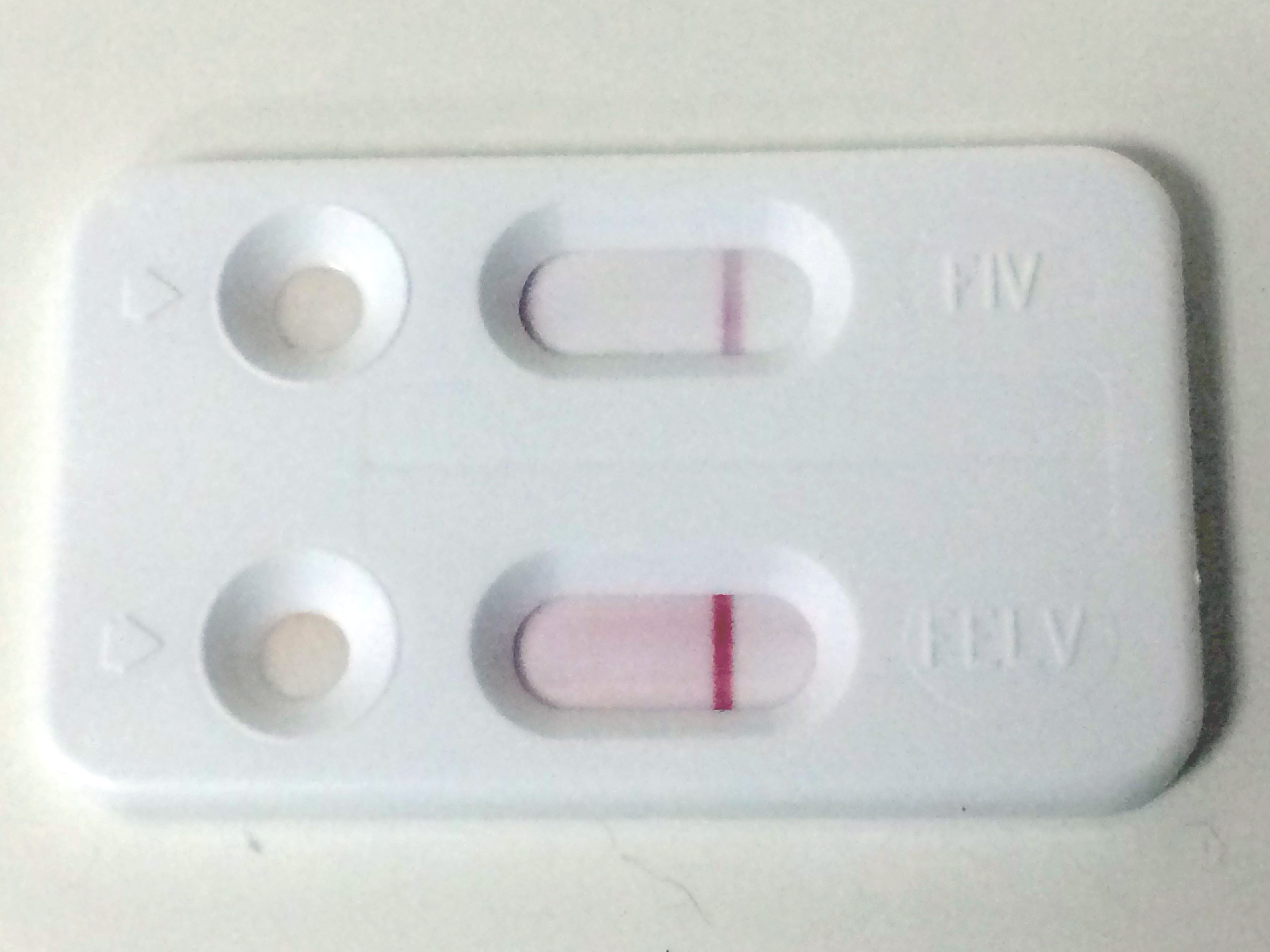 Negatieve FIV/FeLV-test