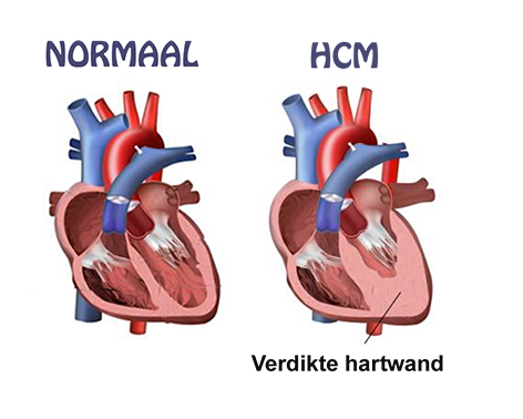 HCM kat