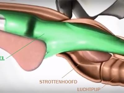 De V-gel schuift over het strottenhoofd en sluit de slokdarm af.